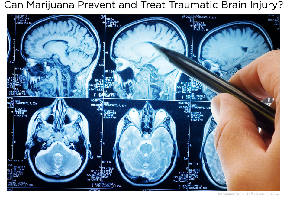 BrainInjury1Featured950x700Image16.jpg